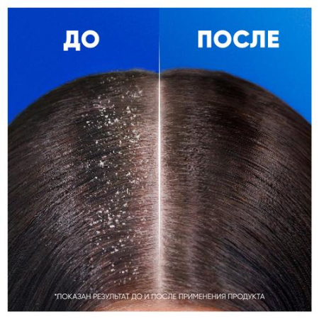 Шампунь (400мл) Head & Shoulders от перхоти Ментол в интернет-магазине ГК Эксперт